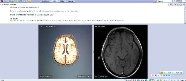 卵蛋图解最新版本已发布新增高清解剖图和3D模型